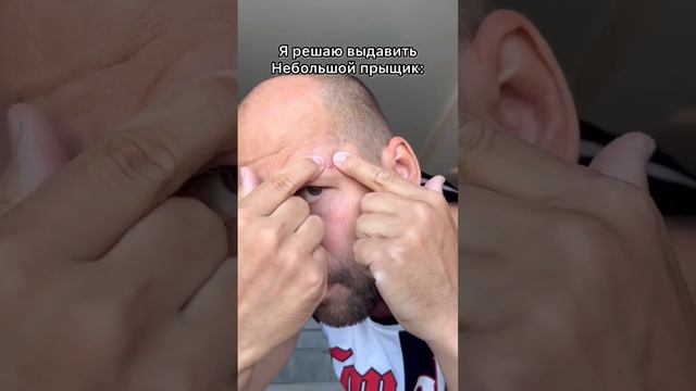 Лайфхакер! Что делать с прыщами смотреть онлайн