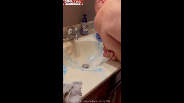 Фурункул / Furunculosis