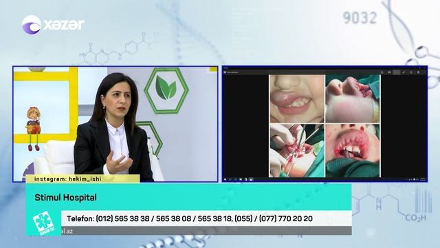 Məmə şəkilləndirməsi, qarın gərmə, blefaroplastika və liposaksiya - HƏKİM İŞİ 21.05.2018 смотреть онлайн