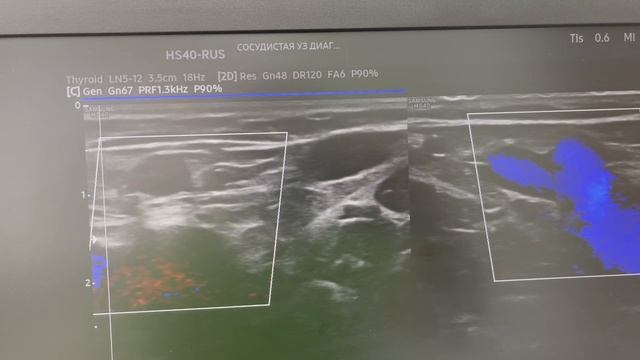 На приём пришла супермодель. Флеболог Москва смотреть онлайн