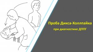 Проба Дикса-Холлпайка при диагностике ДППГ | ДППГ