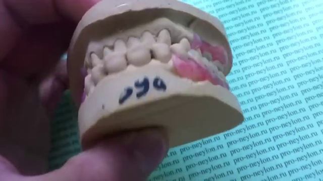 Частичные нейлоновые протезы смотреть онлайн