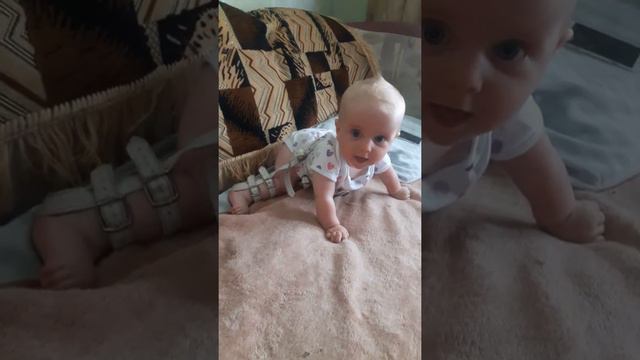 After hip displasiya :) смотреть онлайн