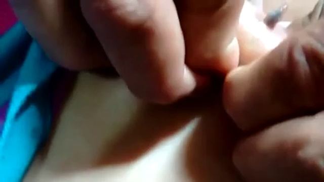 Remove the worm from the body so big worm. смотреть онлайн