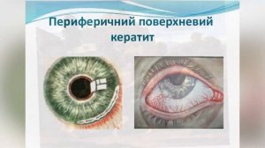 Воронежская офтальмологическая больница