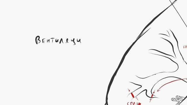 Тромбоэмболия легочной артерии (ТЭЛА). смотреть онлайн