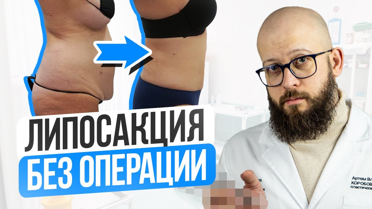 СТРАШНЫЕ ПОСЛЕДСТВИЯ безоперационной липосакции смотреть онлайн