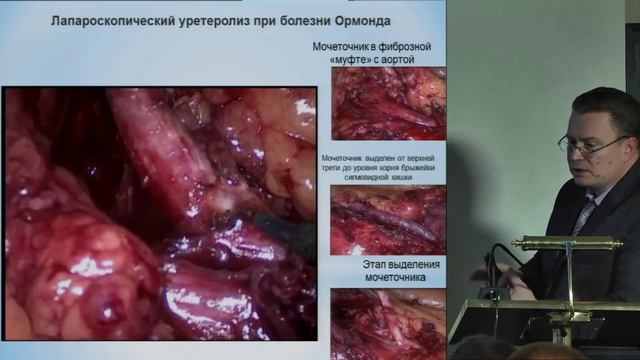 Р.Н. Трушкин – Современные технологии в экстренной урологии.