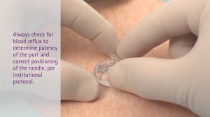 Установка иглы Губера Surecan Safety II, B Braun