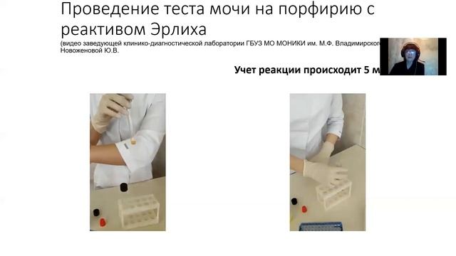 Неврологические проявления порфирии смотреть онлайн