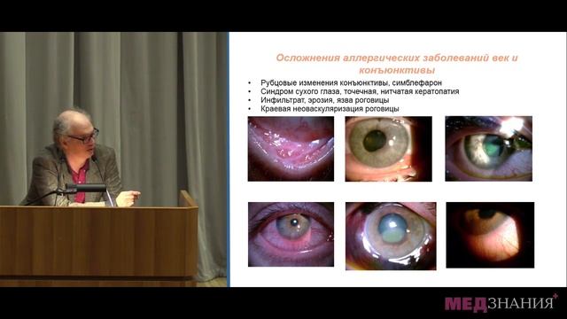 2. «Аллергические заболевания переднего отрезка глаза» Н. Р. Марченко смотреть онлайн
