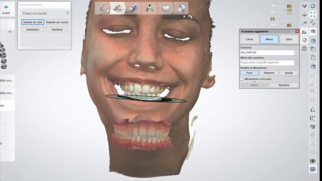 3Shape intraoral scanner with Thunk3D facial 3D scanner for face scan, DSD, maxillofacial смотреть онлайн