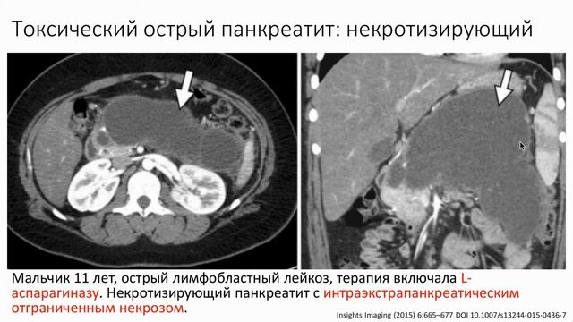 Осложнения у онкологических пациентов. Практическая школа рентгенолога - Цориев Андрей Эльдарович смотреть онлайн