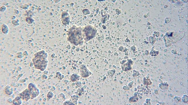 Sera Bio-Nitrivec: Bactérias Vivas / Living Bacteria / Lebende Bacterien