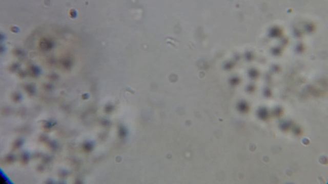 aquarium water after 7 days, microscope x1000 / вода из аквариума под микроскопом x 1000 смотреть онлайн