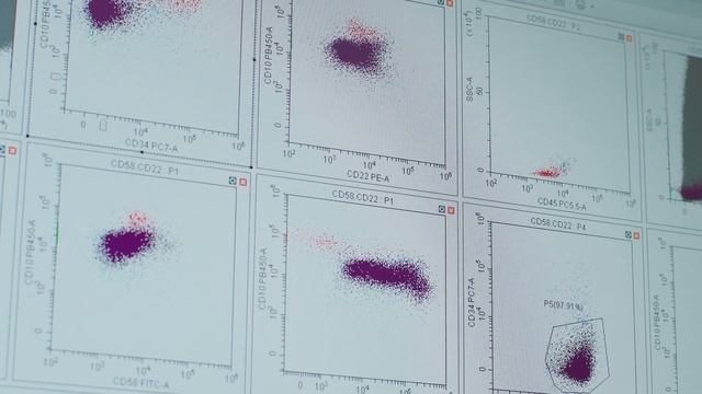 Обновление технологической базы Центра детской онкологии и гематологии ОДКБ г.Екатеринбурга 2022 го смотреть онлайн