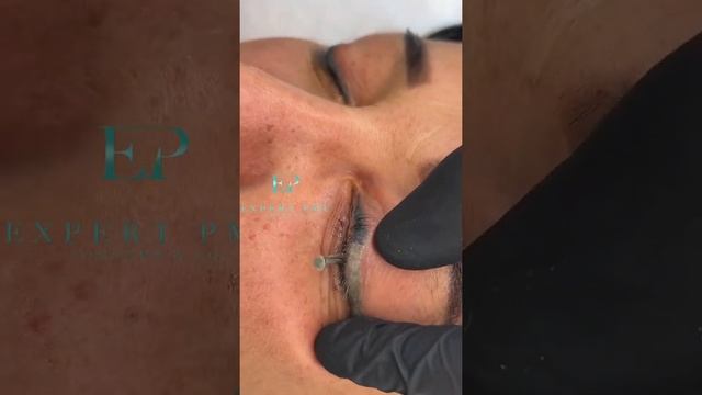 Удаляем синие стрелки на глазах! смотреть онлайн