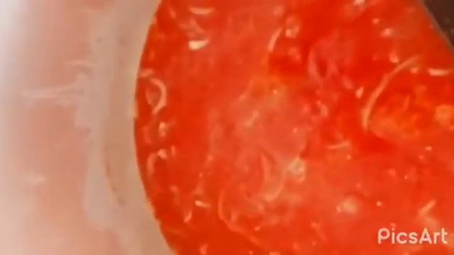 Супер# Лечо ???? смотреть онлайн