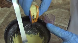 Изготовление литой культевой штифтовой вкладки непрямым (косвенным) методом