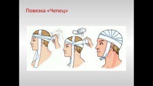 ОБЖ. Азы десмургии. Повязка на голову «Чепец»