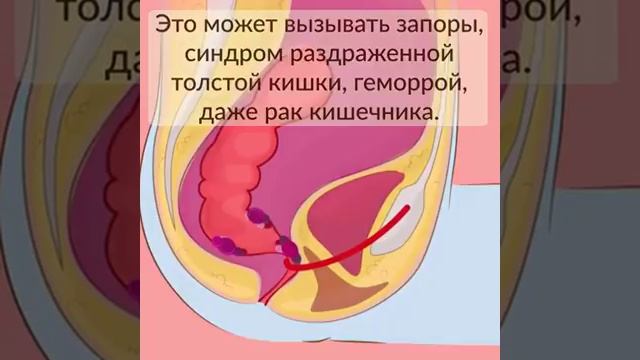 Как правильно сидеть в туалете