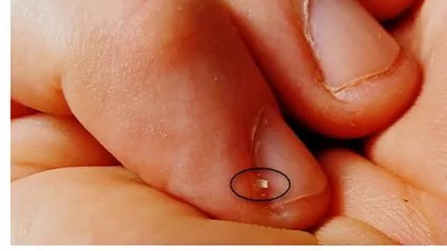 Вот Почему Вы Не Должны Откусывать Кожу Вокруг Ногтей! смотреть онлайн