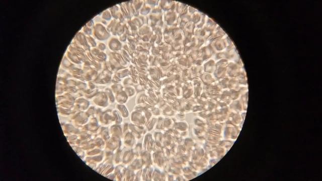 Кровь после маски. А вы знали? смотреть онлайн