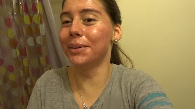 I TESTED THE ORDINARY PEELING SOLUTION FOR MY ACNE SCARS ONE MONTH LONG.. THIS IS THE FULL REVIEW смотреть онлайн