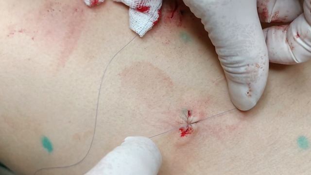 Шугаринг: деликатность и эффективность в одном процессе