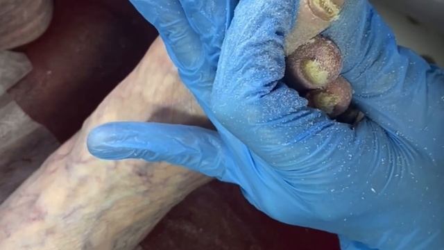 Сложная зачистка ногтей смотреть онлайн