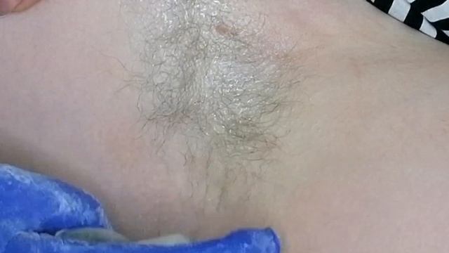Шугаринг. Удаление длинных волос подмышками. смотреть онлайн