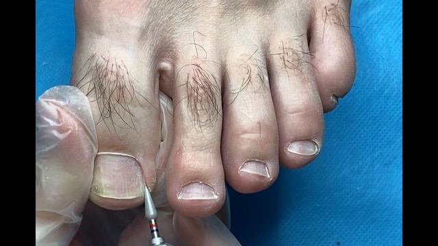Мужской Аппаратный ПЕДИКЮР Безопасная фреза в педикюре смотреть онлайн
