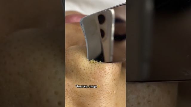 Чистка лица смотреть онлайн