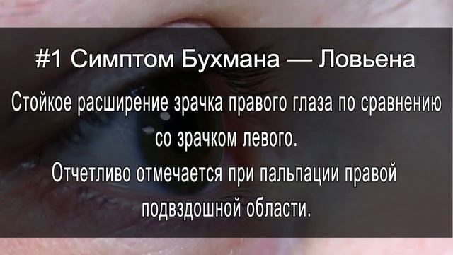 Острый аппендицит: ПЯТЬ симптомов, о которых Вы никогда не слышали (скорее всего)