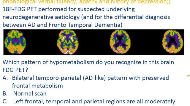 IAEA/EANM webinar - Introduction to Nuclear Medicine in Neurology: bases for clinical use смотреть онлайн