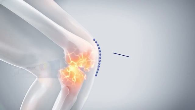 Reklám Voltaren Emulgel Hera - Május 2018 смотреть онлайн