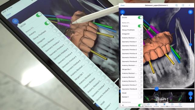 Тайм-менеджмент в цифровой ипмлантологии/JDigital/RealGuide смотреть онлайн