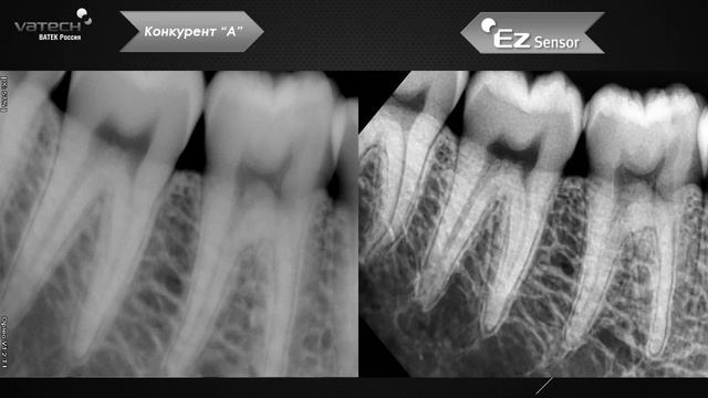 Intra oral sensor image resolution смотреть онлайн