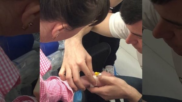 Постановка катетера