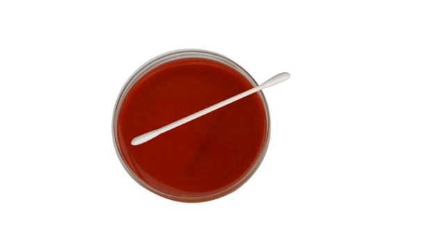 Why & What is Optochin Disk Test ? ( Clear Explain ) смотреть онлайн