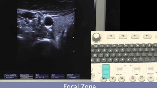 SonoScape S8 Color Doppler Ultrasound Machine Setup Keyboard смотреть онлайн