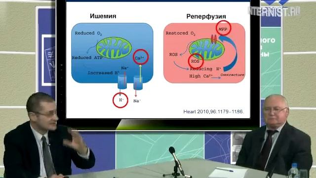 Реперфузионные повреждения у больных с инфарктом миокарда и подходы к их коррекции. ч.1 смотреть онлайн