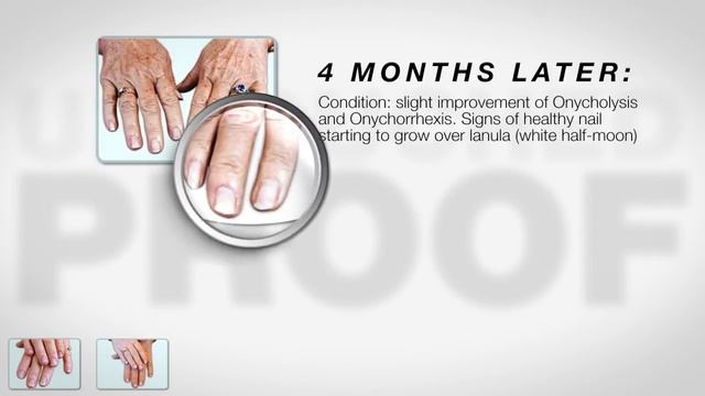 Bio Sculpture Gel Safety Rating: Client Testimonial смотреть онлайн