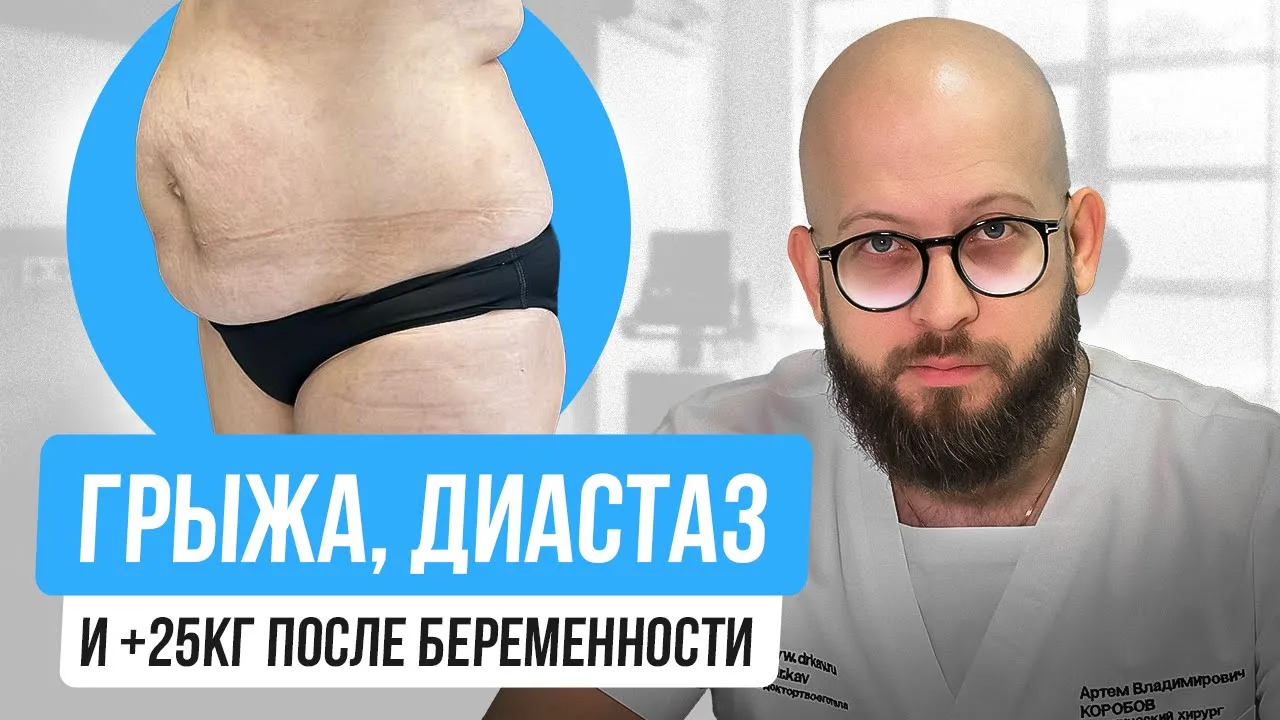 "Я забила на фигуру после родов и не узнала себя" - Трансформация и восстановление после родов смотреть онлайн