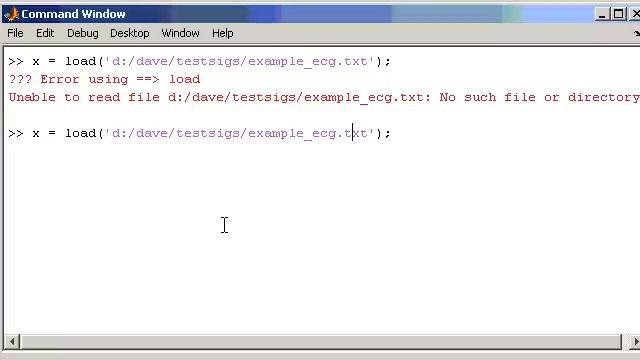 Matlab Demonstration of reading a Discrete ECG Signal from a file смотреть онлайн