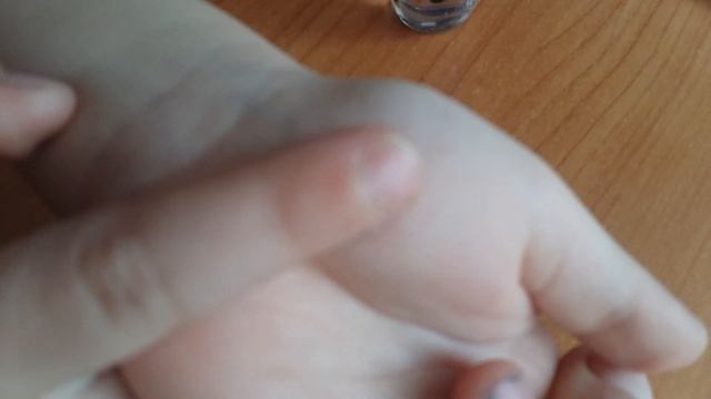 Как избавиться от шипиги смотреть онлайн