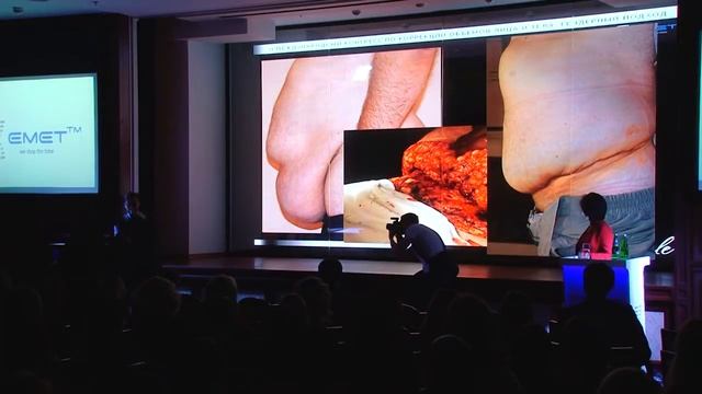 Сергей Хаустов Vs Ирина Капшученко на II Международном конгрессе 22.02.2017