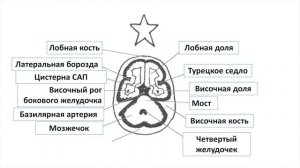 8 минут за которые ты научишься читать МРТ и КТ