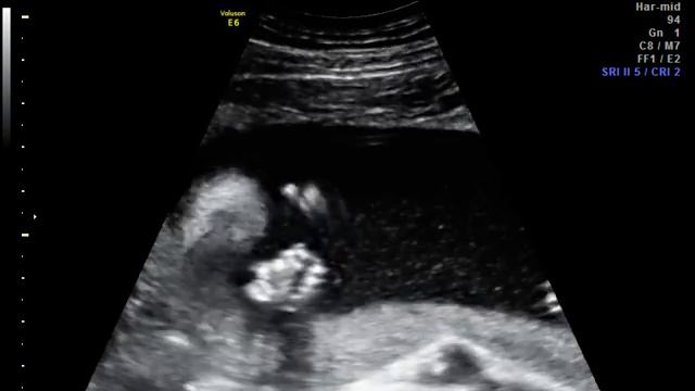 Плод - Хулиган смотреть онлайн