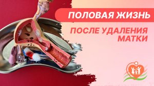 ? Половая жизнь после удаления матки